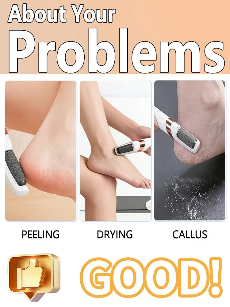 Waterproof Foot Heel Callus Remover Feet Dead Skin Removal Skin Care Tool Electric portable pedicure.